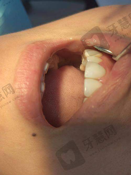 四、蒲杨磊医生真实评价情况