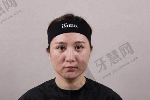 台州丽雅医疗美容医院王海涛医生价格表