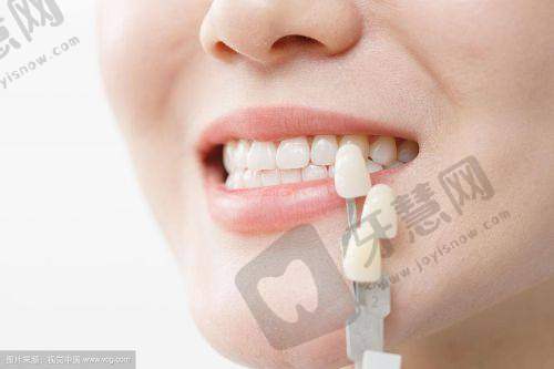 杜欣烨医生怎么挂号预约