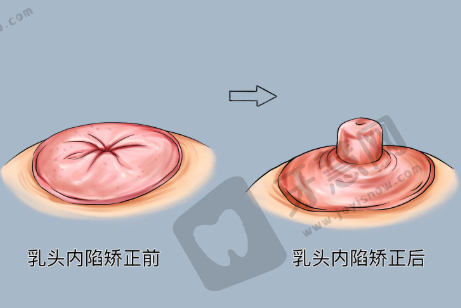 如何选择适合自己的医院和医生