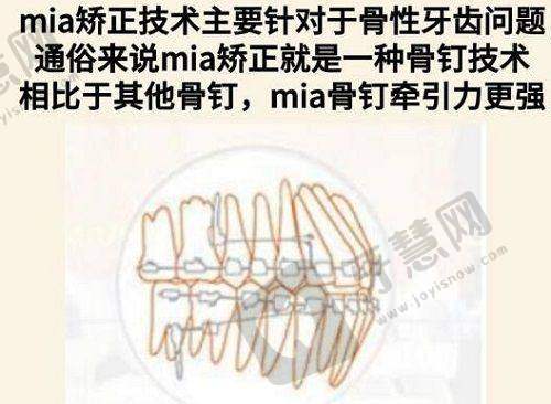 碧莲盛植发技术优势详解