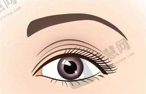 选择整形医院的注意事项