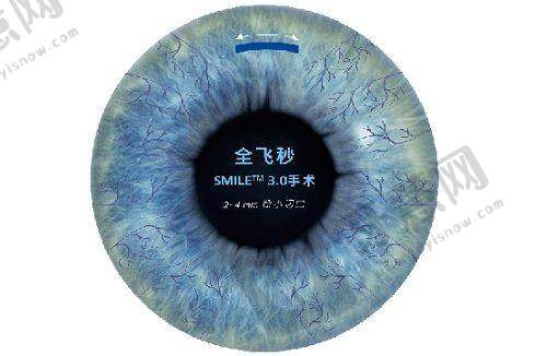北京同仁眼科医院怎么挂号?多渠道攻略助你约魏文斌/翟长斌医生!