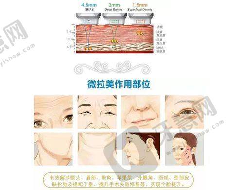 为什么选择石家庄雅芳亚整形医院