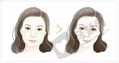 深圳美莱医生团队优势解析