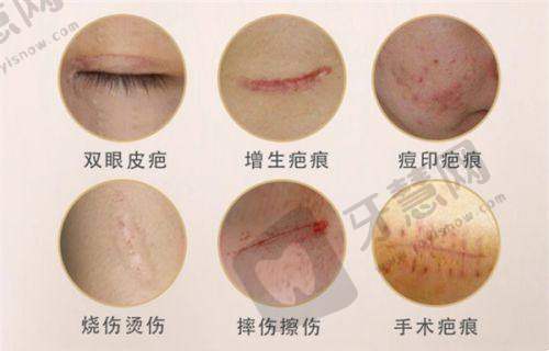 鼻部整形项目价格参考