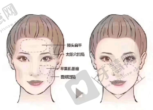 西安伊美尔医美医院口碑究竟咋样?收费合理吗?专家团队与特色服务介绍