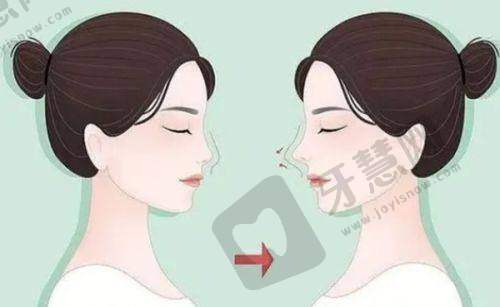 胸部整形项目价格明细