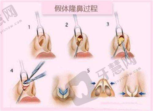 四、合肥艺星医疗美容医院