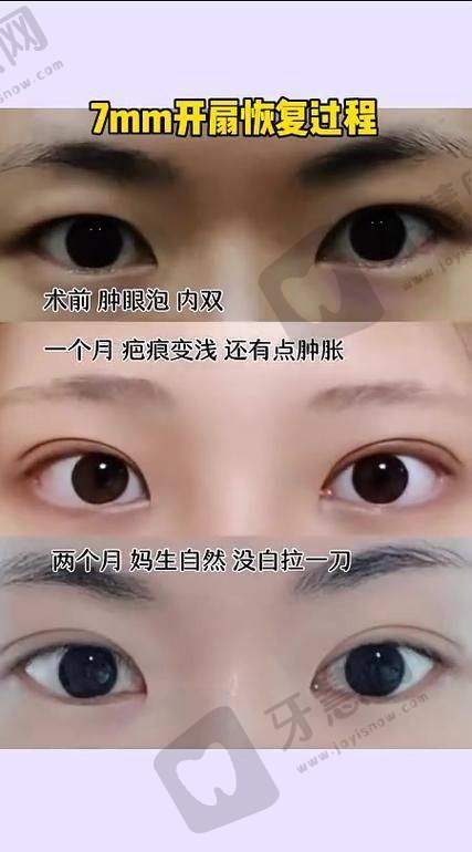 选择正规医院的重要性