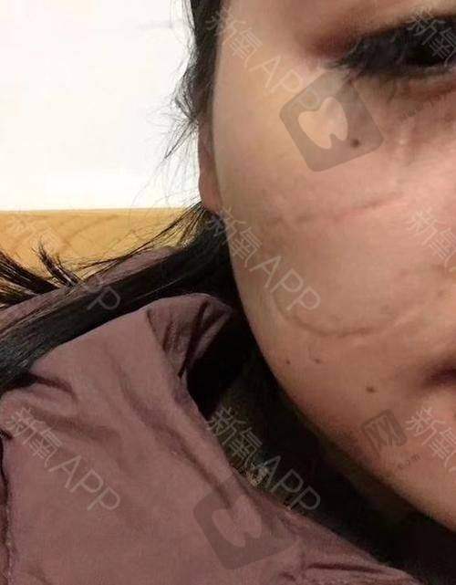 南京其他有名疤痕修复机构