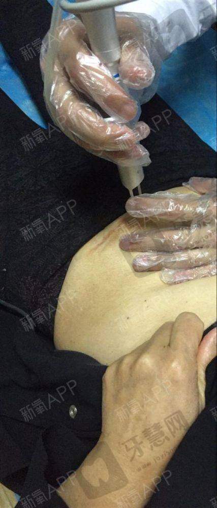 南京华美整形医院