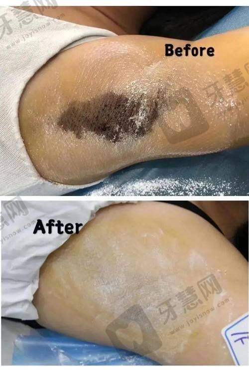 专精医生推荐