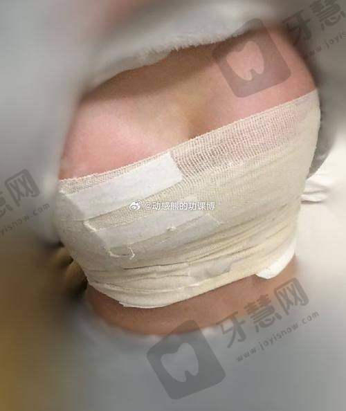 其他优质隆胸医院推荐