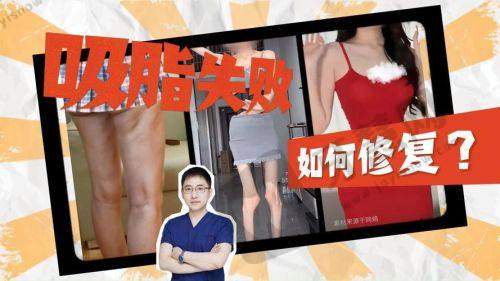 选择建议与注意事项