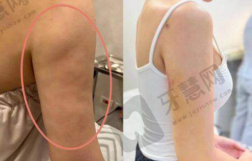 价格透明度与性价比分析