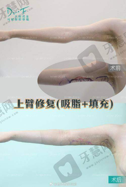 患者口碑与术后服务