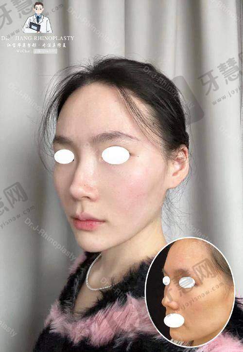 如何选择适合自己的鼻修复医生?