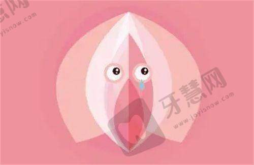 黄广香医生技术优势