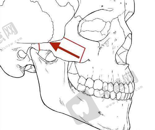 黄广香医生擅长项目