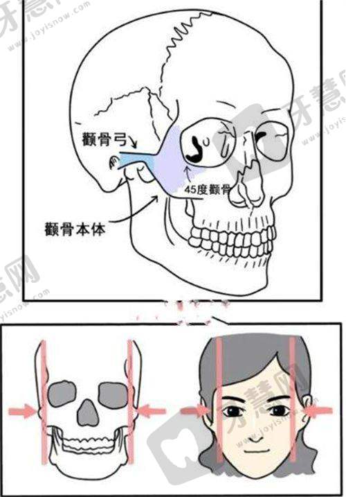 朱云医生技术优势