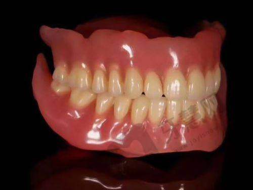 鼎植口腔种植牙性价比分析