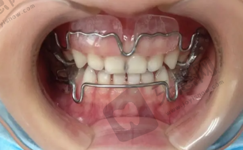 南京浦口德福口腔医院几点上班?营业时间、交通、特色项目全揭秘