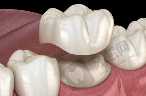 兰州种植牙哪家医院好?不吹不黑,看牙好的三巨头牙科上榜之洛阳友好小白兔牙科