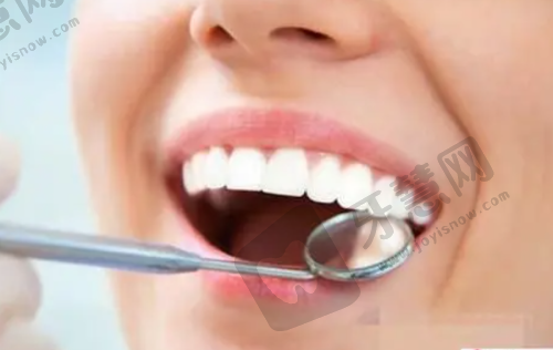 长沙市口腔医院哪家又好又便宜?长沙中诺美奥德韩等6家性价比高牙科推荐