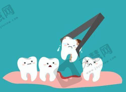 成都安玉牙种植医院正规私立吗?技术强收费优,不愧是老年人种牙优选