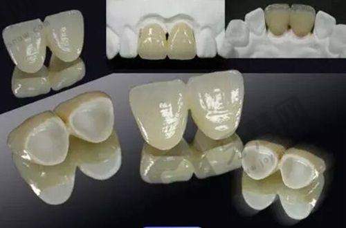 鄂尔多斯中诺口腔医院患者预约挂号后的就诊体验