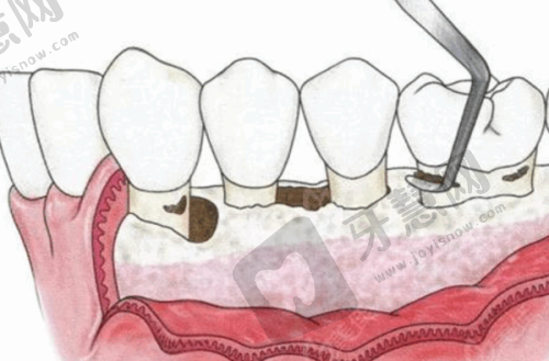上海同济口腔正畸费用2万 - 6万元起,涵盖儿童与成人矫正多种方案