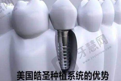 不同矫正方式的详细对比