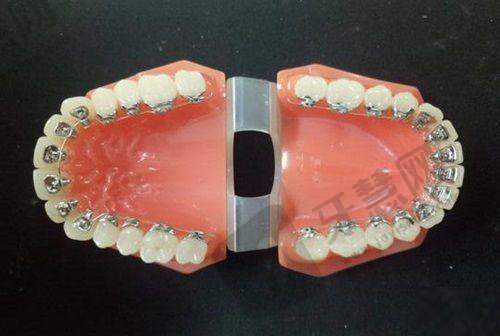 南京看牙医院在线预约报名之挂号避坑与注意事项