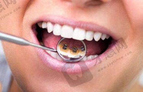 严格的消毒灭菌体系