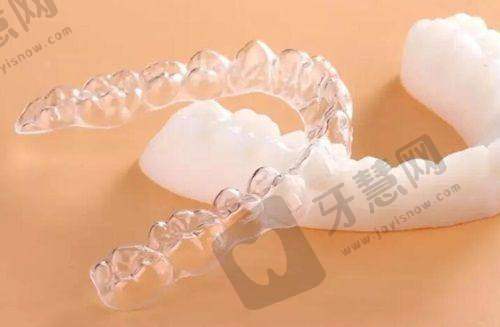 种植牙选择指南与注意事项