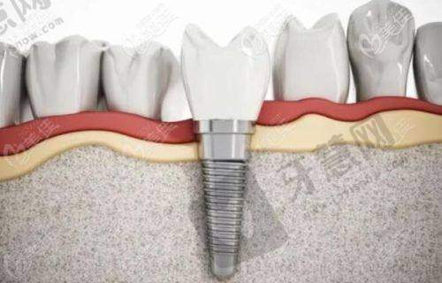 二、徐明志医生手术费用详情
