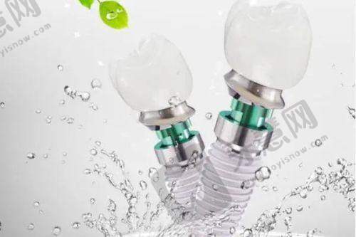 兰州那家医院拔牙便宜之兰州台牙口腔医院