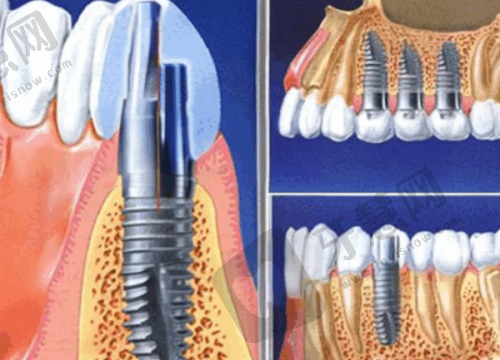 长沙10家高性价比牙科医院排名