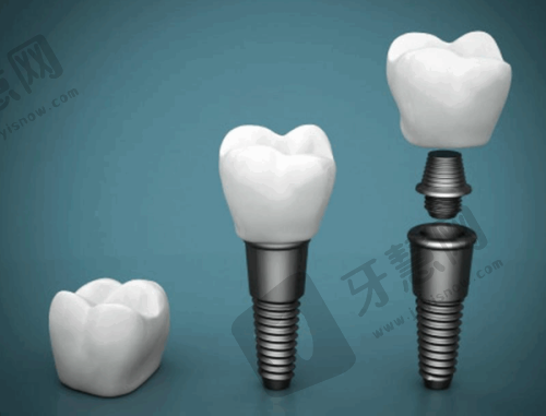 选择建议与注意事项