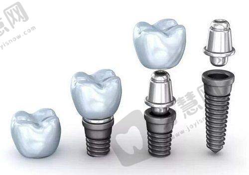 马方医生手术费用