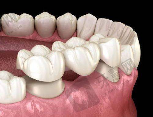 如何选择适合自己的牙科医院