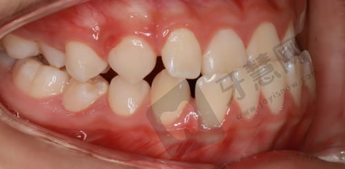 鄂尔多斯中诺口腔医院的医生团队实力如何