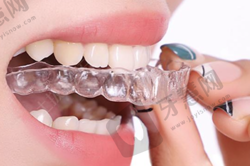 西安海涛口腔医院种植牙技术靠谱吗？2025收费标准及患者口碑介绍在这