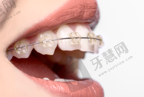 长沙优伢仕口腔医院