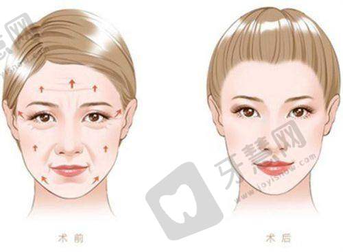 朱云医生真实实例