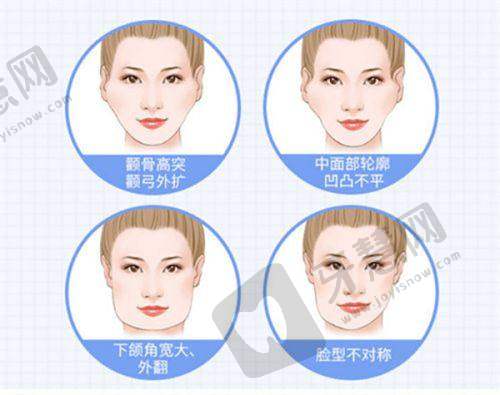 总结