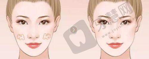 黄广香医生真实实例