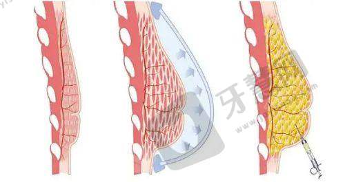 南京皮肤研究所整形美容科怎么样——激光祛斑情况