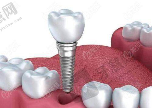 三、徐明志医生做完手术患者的感觉